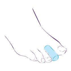 СТ-44 Приспособление корригирующие (колпачок защитный)