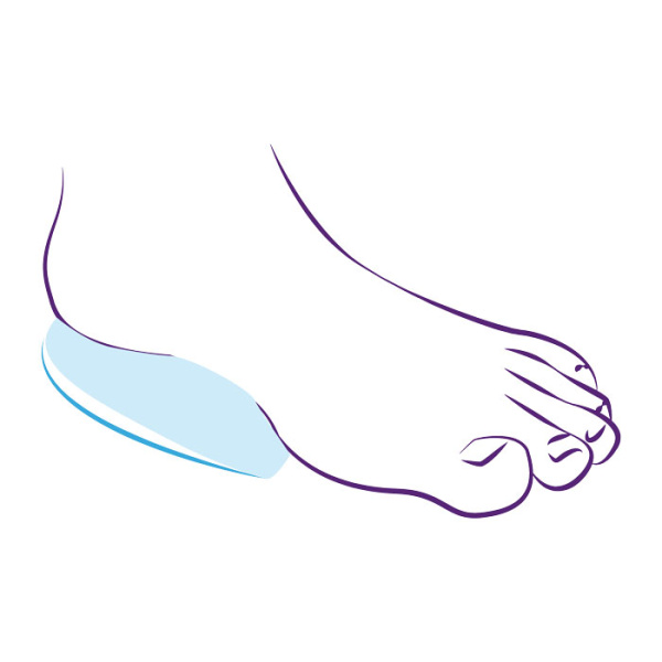 Подпяточник с супинатором и амортизатором пятки СТ-62  Trives